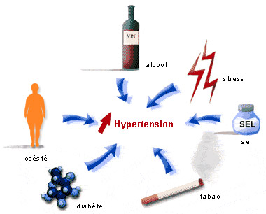 les origines de l'hypertension