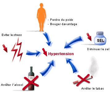 Que faire en cas d'hypertension